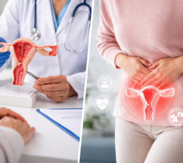 درمان افتادگی رحم در اصفهان