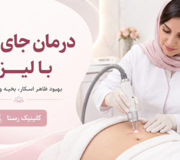 درمان جای زخم با لیزر در اصفهان